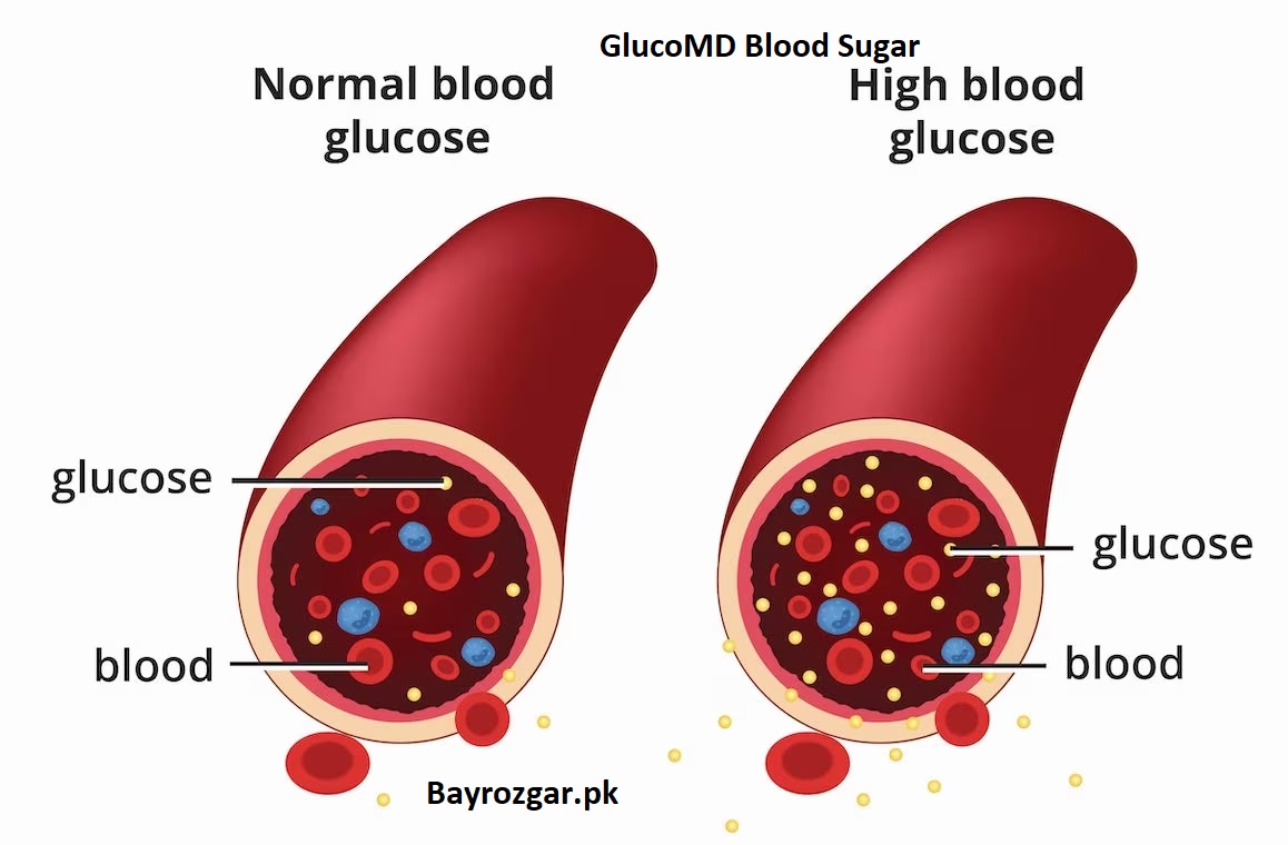 GlucoMD Blood Sugar Control